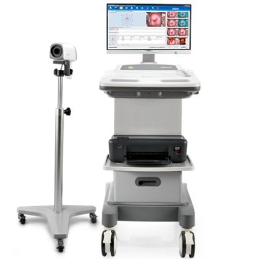 MÁY SOI CỔ TỬ CUNG